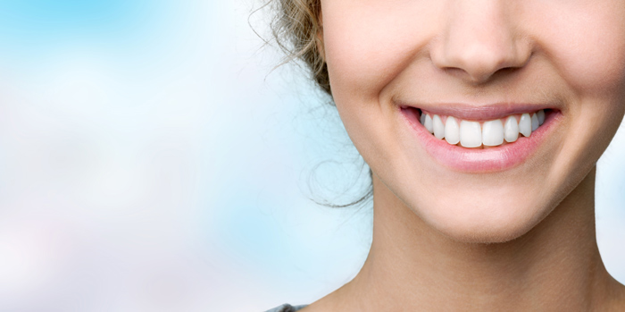 Implantate bei Frau mit weißen Zähnen