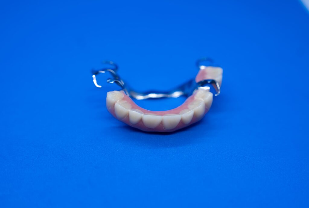 Zahnprothese auf blauem Hintergrund, aus Kunststoff und Metall, mit naturgetreuen Zähnen.