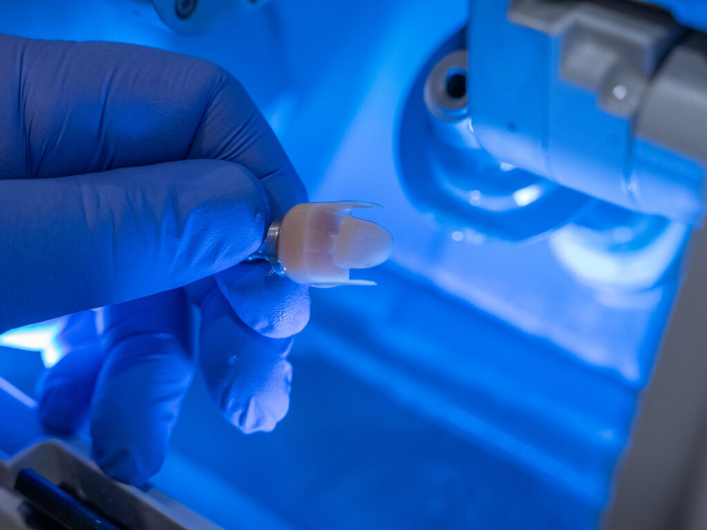 Hand mit blauem Handschuh hält ein Zahnmodell unter blauen Lichtern.